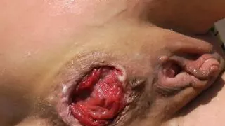 Sindy Rose – self anal fisting in mountain valley & prolapse