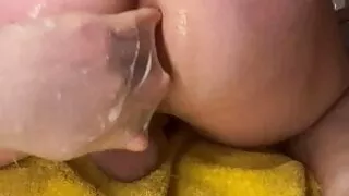 Fist Anal With Condos