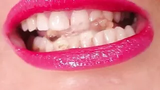 Sharpest teeth, Extreme close-up  #12