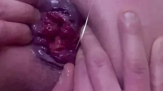 Hard Anal Gape Open Ass Prolapse