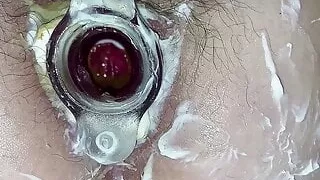 Hot Anal gaping & tunnel plug. Hairy cunt & asshole close-up