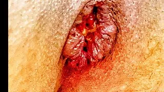 Another Diashow with me, my asspussy and my toys