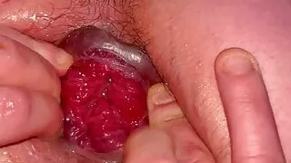 Anal Gape Open Ass  Prolapse
