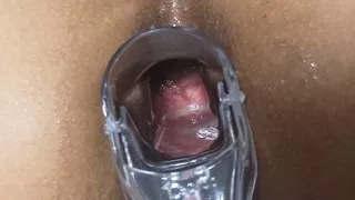 Speculum in my anus