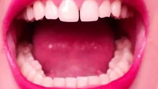 Very sharp natural teeth # 2 – model Anastasia Gree