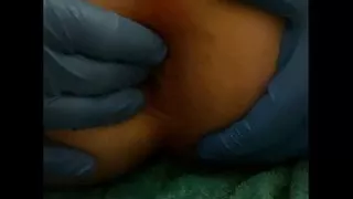 Sticky Micky Amateur anal dildo fun part 2