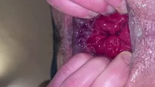 Prolapse Rosebud Open My Ass