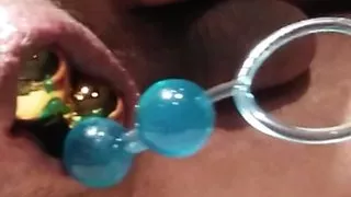 Prolapse dependent on the anus