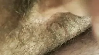 Wastl’s Micro Penis