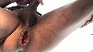 severe anal insertion with a bottle