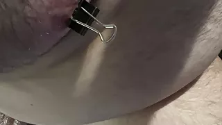 Nipple clamps removed after thirty minutes and more clamps added