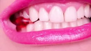 (Preview) Teeth Model Anastasia Gree