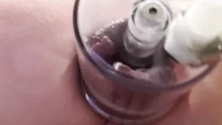 Julie's new anal vacuum box