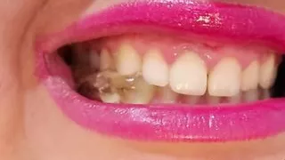 teeth (preview) Model Anastasia Gree