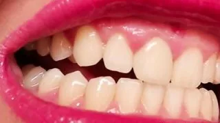 my teeth (preview) Model Anastasia Gree