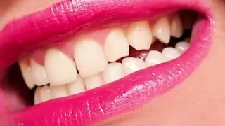 my white teeth (preview) Model Anastasia Gree