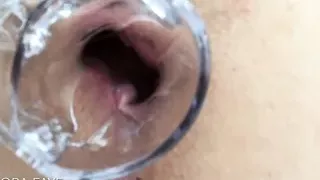 speculum in this dirty slut's ass