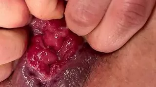 My Big holes - Anal Gape