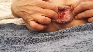 Inflatable plug, 7cm