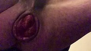 extraordinary anal dilation