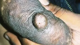 India Mengandung Tetek Bersusu