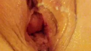 Getting my pussy fisted