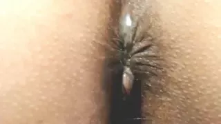 GAPING Amazing anal contractions and farting pussy