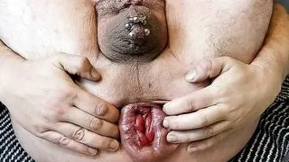 Ballspiele und Prolapse, total ausgeleiert