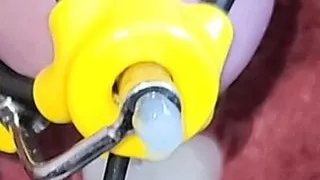 New estim accessory HFO