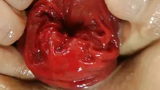 Sindy Rose self anal fisting & ruined asshole prolapse