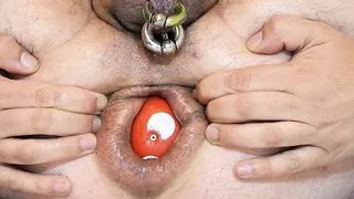 23.07.2022 Extreme Analdehnung fast bis zum Prolaps