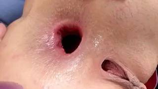 Bei meiner krankenschwester anal bedankt