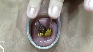 Inserting screwdrivers into my little cervix! - Maya Simons