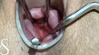 Maya Simons OPENING HER CERVIX (EXTREME)