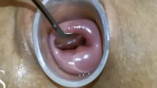 Maya Simons Masturbating her Cervix With a SPOON!