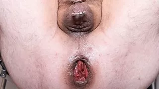 Analdehnung bis an das absolute Limit