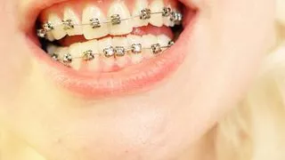 braces mouth tour video - vore fetish