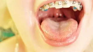 eating in braces - vore and food fetish - close up video