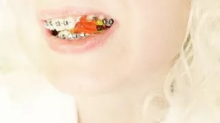 BRACES fetish: ASMR video of eating MUKBANG...