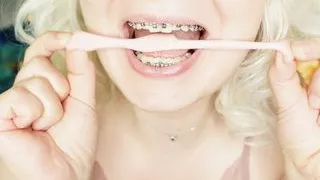 BRACES fetish: ASMR video of eating MUKBANG.