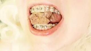 BRACES fetish - ASMR video of eating food MUKBANG...