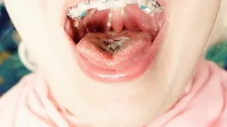 BRACES fetish - ASMR video of eating MUKBANG...