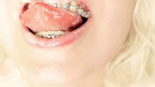 BRACES fetish - ASMR clip of eating MUKBANG...