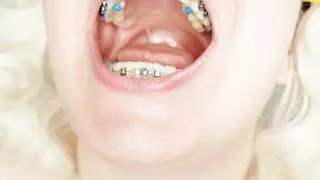 braces fetish: close up video mukbang