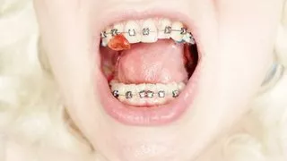 braces fetish: close up video mukbang .