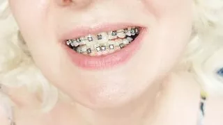 braces fetish: close up video mukbang ..