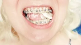 braces fetish: close up video mukbang ...