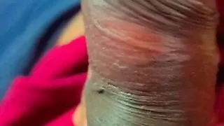 Hostel Boy Flashing Penis Hide Cramea