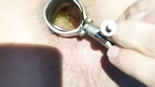 Two anonymous downloads