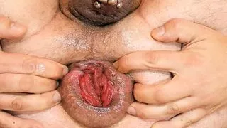 Bis der Mastdarm raus kommt